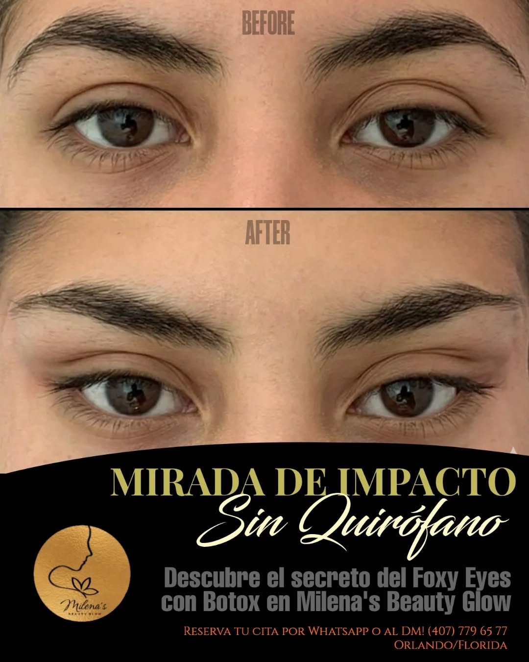 Fibroblast treatment