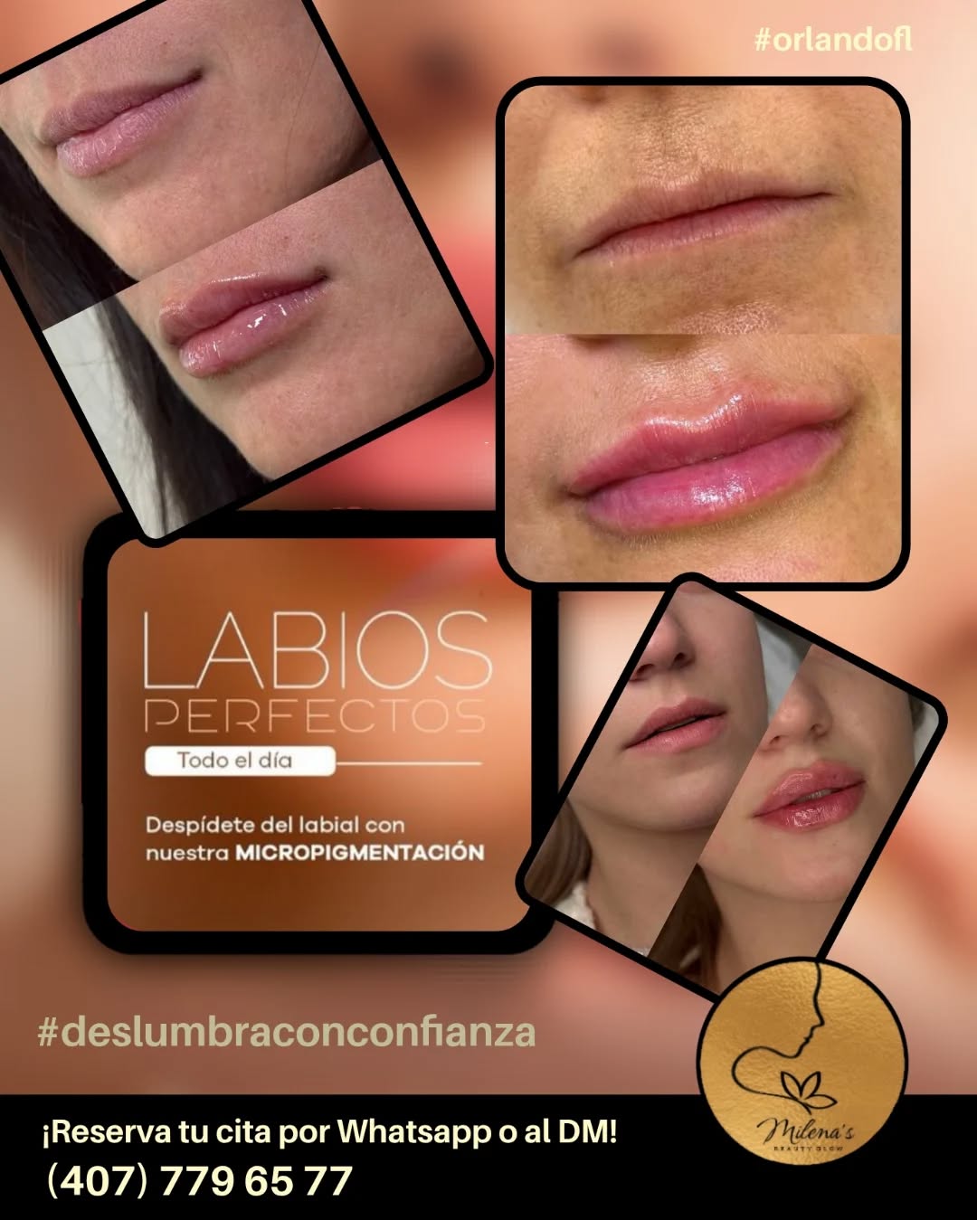 Lip blush micropigmentation
